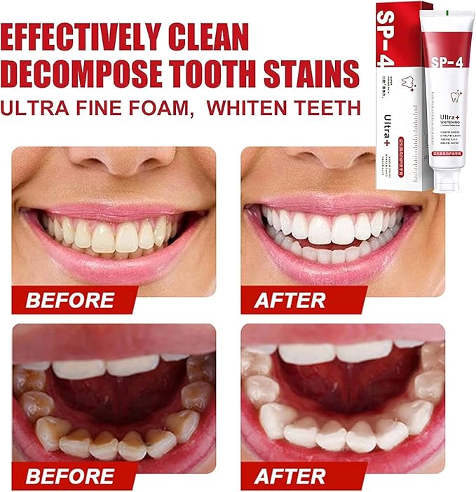 Yayashi SP-4 Probiotic Whitening Toothpaste 120g | Whitening Toothpaste for Coffee, Tea & Smoking Stains | Fresh Breath & Daily Oral Care Toothpaste